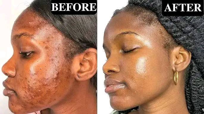 Novira Glow Face Mask Peds