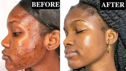 Novira Glow Face Mask Peds